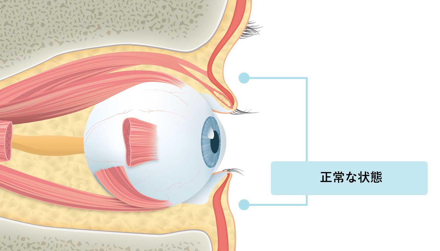 義眼