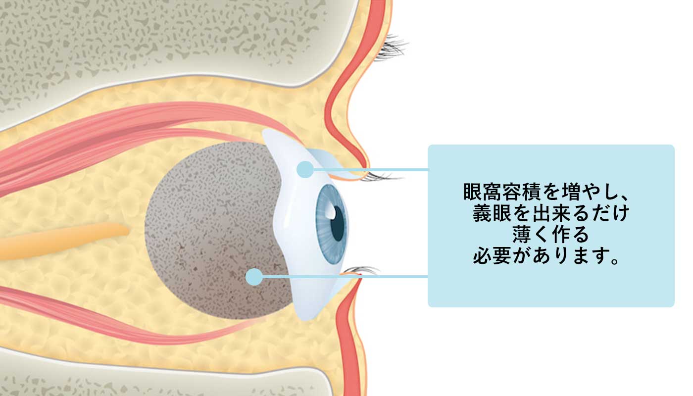 義眼台